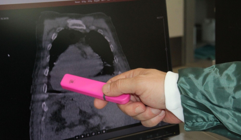 🩺 “Giresun Sendromu”: Tıp Literatürüne Giren Nadir ve İlk Vaka