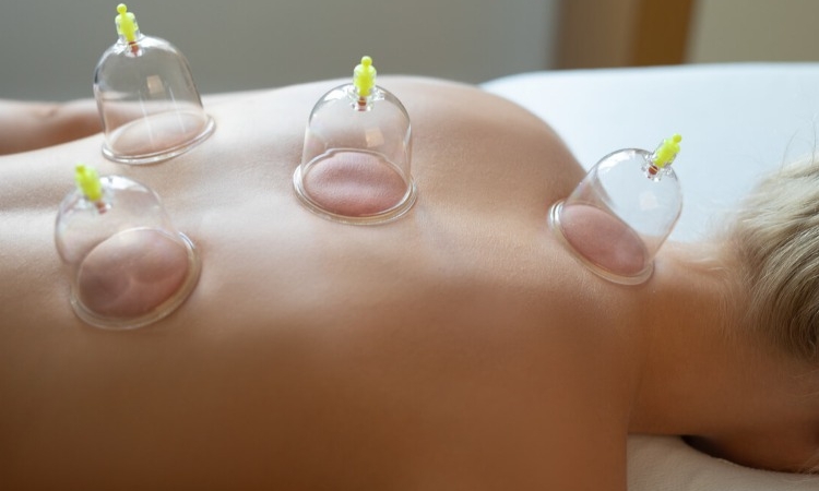 Hacamatın Saç Sağlığına İddia Edilen Faydaları