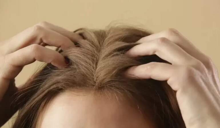 Saç Dipleri Hangi Durumlarda Acır?