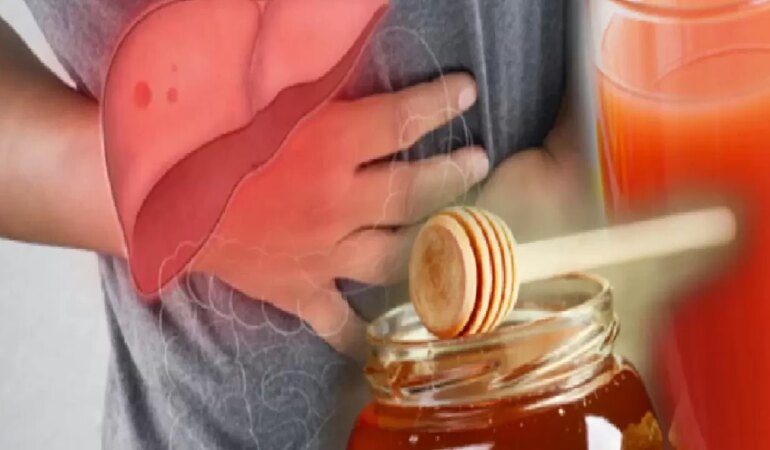 Karaciğer Nasıl Temizlenir?