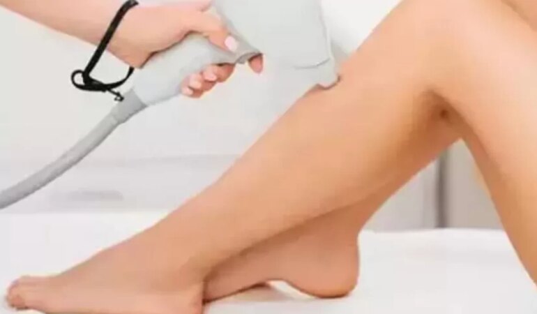 Lazer epilasyon hakkında doğru bilinen 10 yanlış