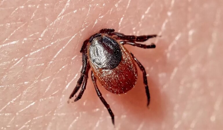 Kene ısırırsa ne yapılmalı?