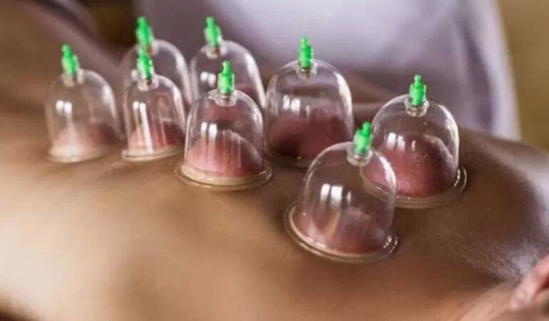 Hacamatın cilde faydaları