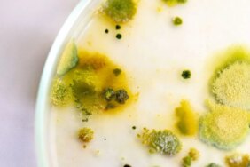 7253-kuflu-yogurt-faydali-mi-zararli-mi.jpg
