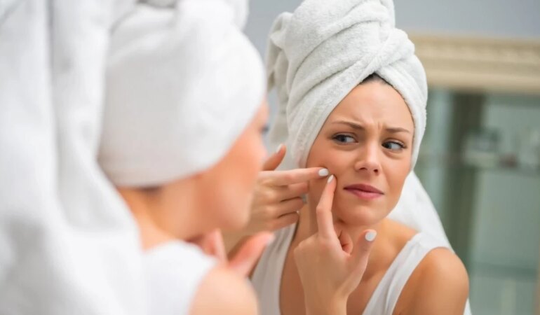 Sivilce izlerine elveda!