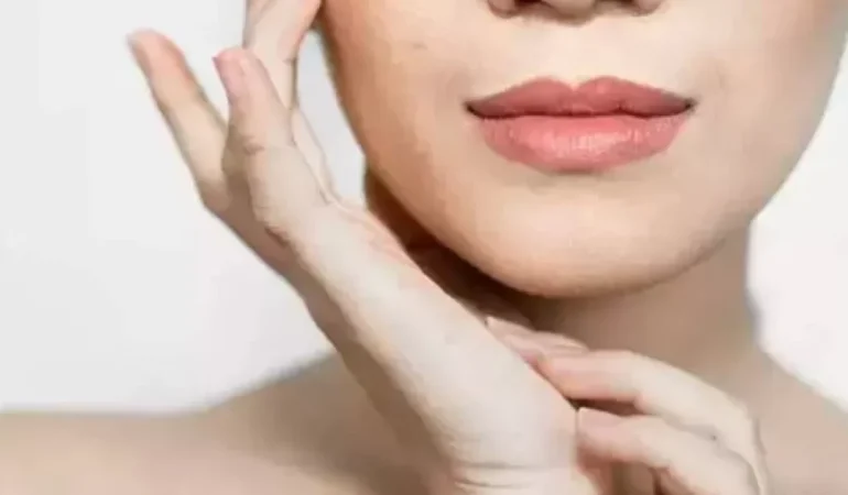 Hamilelikte cilt lekelerine karşı ne yapılmalı?