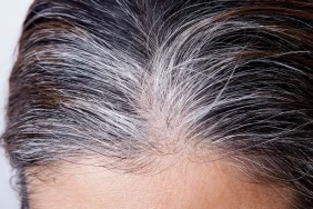 9272-beyazlayan-saclarinin-asil-nedeni-ortaya-cikti-meger-her-seye-sebep-o-hormonmus.jpg