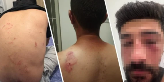 Kürtçe konuştukları için saldırıya uğradılar