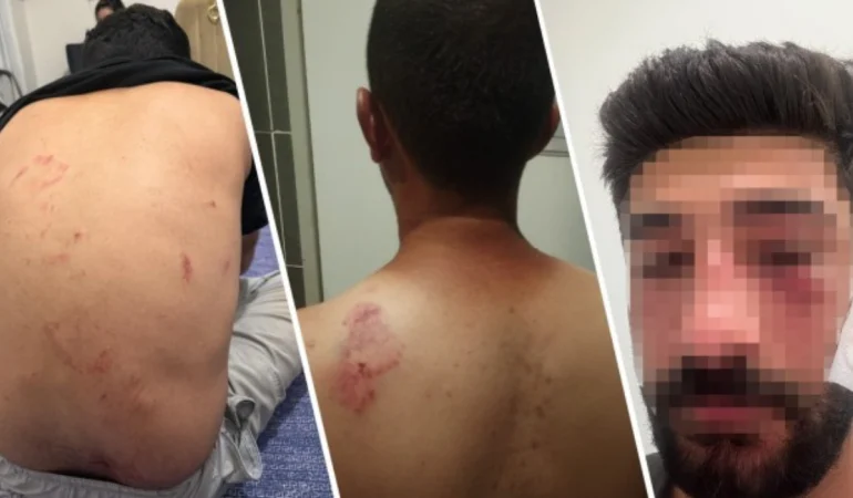 Kürtçe konuştukları için saldırıya uğradılar