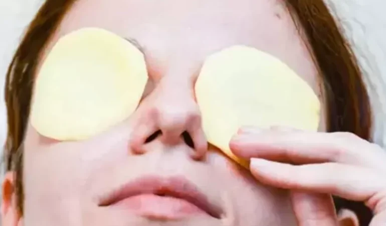 Göze patates koymanın faydaları