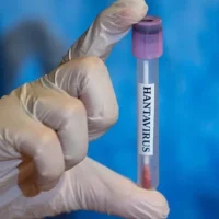 htWu-hantavirus-turkiyede-var-mi-yok-mu-hantavirus-hangi-ulkelerde-goruldu.jpg