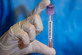 htWu-hantavirus-turkiyede-var-mi-yok-mu-hantavirus-hangi-ulkelerde-goruldu.jpg