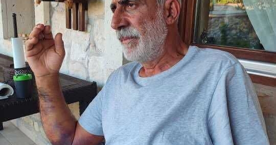Engerek yılanının ısırdığı yazar Cemal Taş taburcu edildi: Kolumda hala his kaybı var